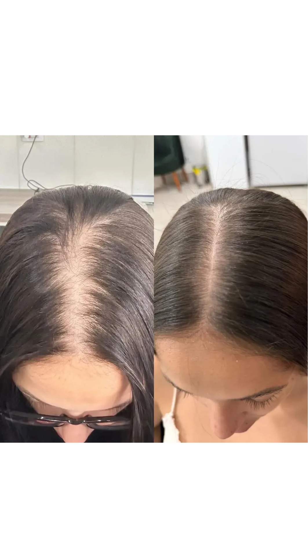 Сироватка для відновлення росту волосся DHTControl & Hairgrow Complex 5.О